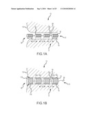 Inflatable device for enteric fistula treatment diagram and image