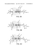 Inflatable device for enteric fistula treatment diagram and image