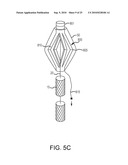 Inflatable device for enteric fistula treatment diagram and image