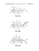 Inflatable device for enteric fistula treatment diagram and image