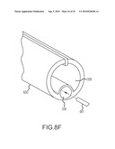 Inflatable device for enteric fistula treatment diagram and image