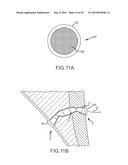 Inflatable device for enteric fistula treatment diagram and image