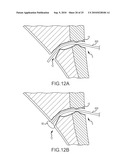 Inflatable device for enteric fistula treatment diagram and image