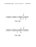 Inflatable device for enteric fistula treatment diagram and image