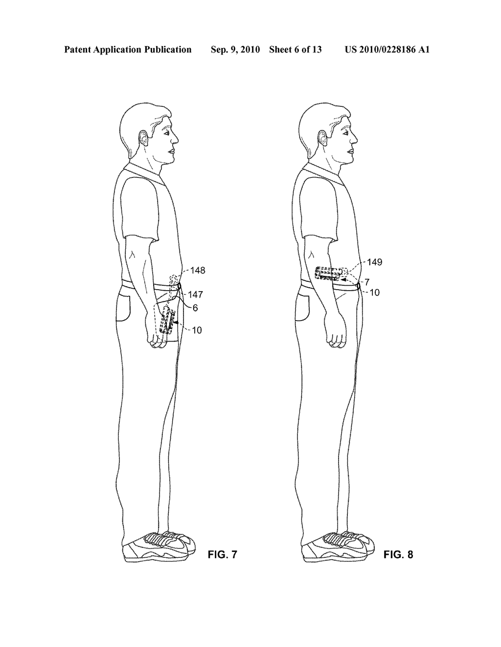 Operating A Portable Medical Device - diagram, schematic, and image 07