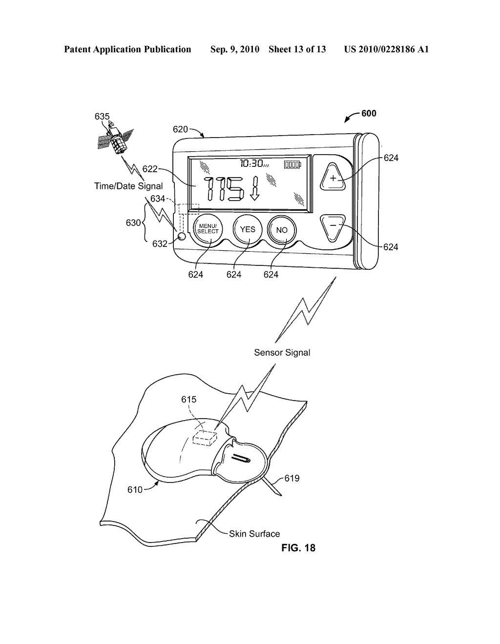 Operating A Portable Medical Device - diagram, schematic, and image 14