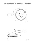 WOUND COVER CONNECTING DEVICE diagram and image