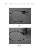 DUAL ACCESS SINUS SURGERY METHODS AND SYSTEMS diagram and image