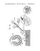 METHODS AND APPARATUS FOR HEMOSTASIS FOLLOWING ARTERIAL CATHETERIZATION diagram and image