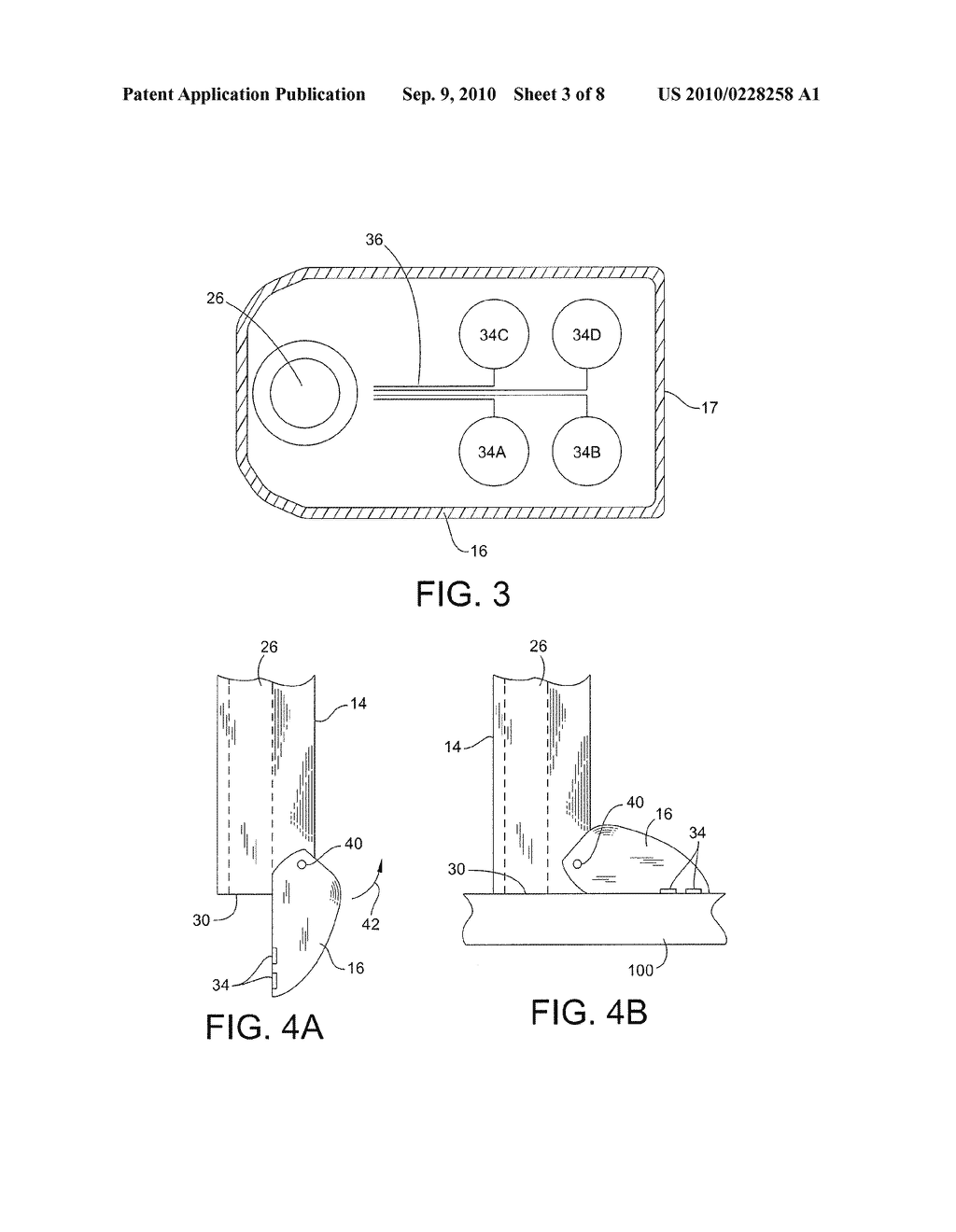 INTRAMEDULLARY NAIL TARGETING DEVICE - diagram, schematic, and image 04