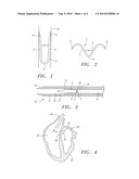 Clip Apparatus For Closing Septal Defects And Methods Of Use diagram and image