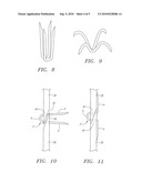 Clip Apparatus For Closing Septal Defects And Methods Of Use diagram and image