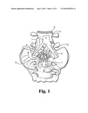 ANTERIOR PLATING SYSTEM AND METHOD diagram and image