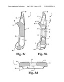 ANTERIOR PLATING SYSTEM AND METHOD diagram and image