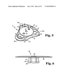 ANTERIOR PLATING SYSTEM AND METHOD diagram and image