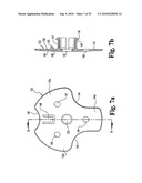 ANTERIOR PLATING SYSTEM AND METHOD diagram and image