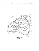 ANTERIOR PLATING SYSTEM AND METHOD diagram and image