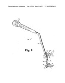 ANTERIOR PLATING SYSTEM AND METHOD diagram and image