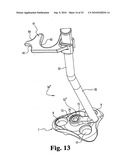 ANTERIOR PLATING SYSTEM AND METHOD diagram and image