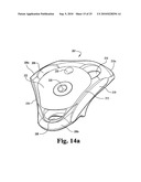 ANTERIOR PLATING SYSTEM AND METHOD diagram and image