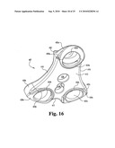 ANTERIOR PLATING SYSTEM AND METHOD diagram and image