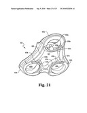 ANTERIOR PLATING SYSTEM AND METHOD diagram and image