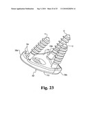 ANTERIOR PLATING SYSTEM AND METHOD diagram and image