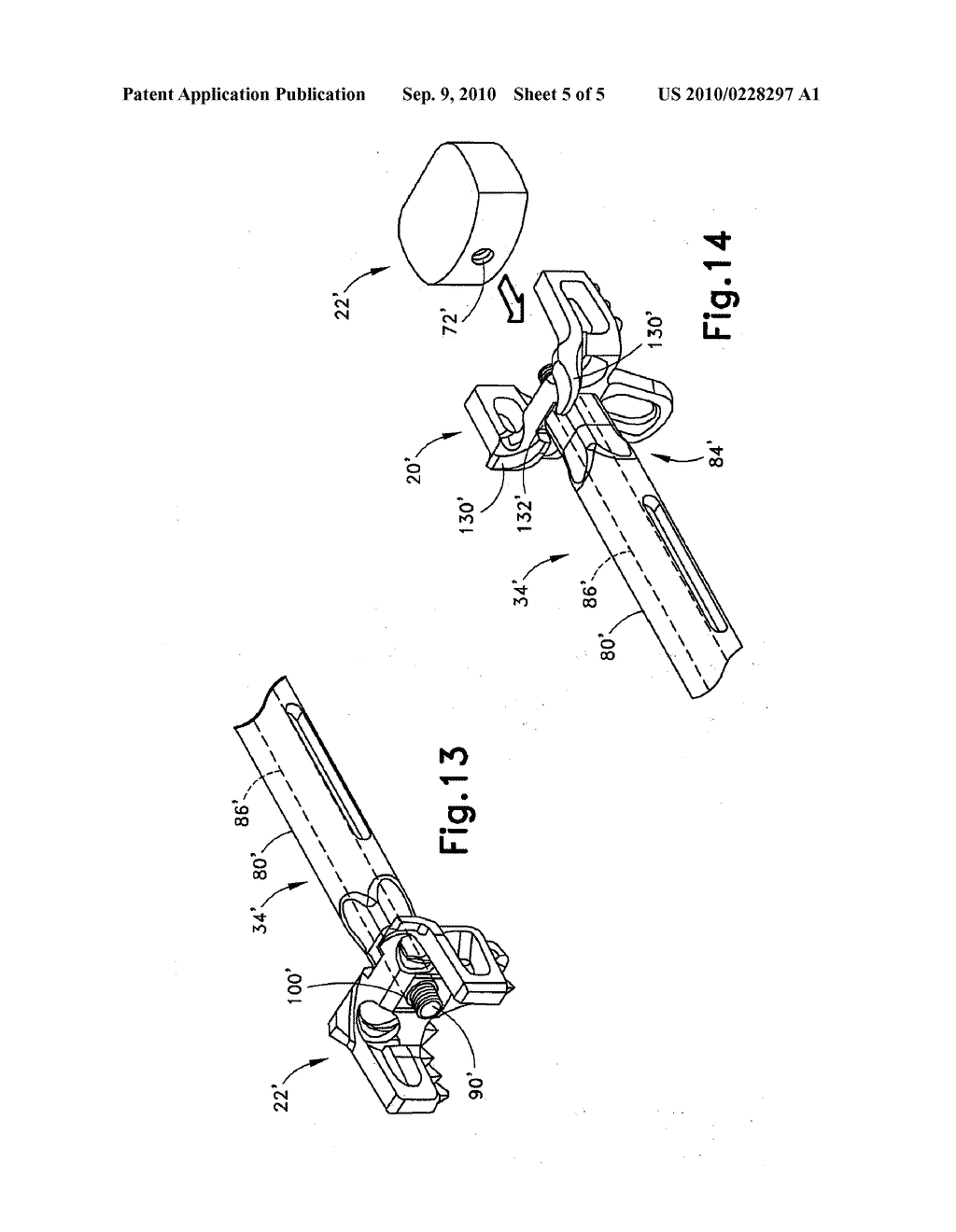 SELECTIVE IMPLANTATION KIT AND METHOD INCLUDING TOOL FOR SPACER AND/OR CONTROLLED SUBSIDENCE DEVICE - diagram, schematic, and image 06