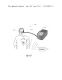 ADAPTIVE BAROREFLEX STIMULATION THERAPY FOR DISORDERED BREATHING diagram and image