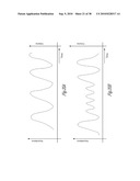 ADAPTIVE BAROREFLEX STIMULATION THERAPY FOR DISORDERED BREATHING diagram and image