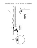 Electronic Identification of External Cables for External Medical Devices diagram and image