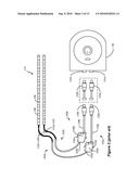 Electronic Identification of External Cables for External Medical Devices diagram and image