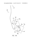 LEAD CONFIGURED FOR HISIAN, PARA-HISIAN, RV SEPTUM AND RV OUTFLOW TRACT PACING diagram and image