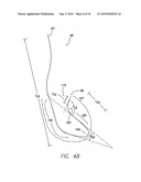 LEAD CONFIGURED FOR HISIAN, PARA-HISIAN, RV SEPTUM AND RV OUTFLOW TRACT PACING diagram and image