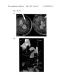 STABLE, FERTILE, HIGH POLYHYDROXYALKANOATE PRODUCING PLANTS AND METHODS OF PRODUCING THEM diagram and image