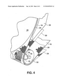 System and Process for Throughdrying Tissue Products diagram and image