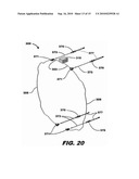 ACTUATION SYSTEM FOR A TRANSLATING VARIABLE AREA FAN NOZZLE diagram and image