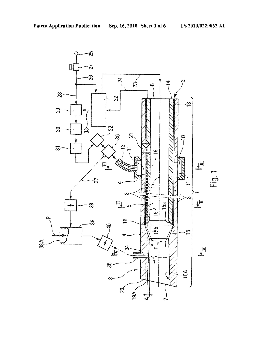 DEVICE FOR RESPIRATORY ASSISTANCE - diagram, schematic, and image 02