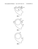 Float pack assembly and method of use diagram and image