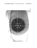 Application of neuro-ocular wavefront data in vision correction diagram and image