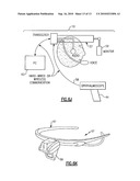 EYE VIEWING DEVICE COMPRISING VIDEO CAPTURE OPTICS diagram and image