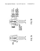 CARDIOVASCULAR X-RAY DIAGNOSTIC SYSTEM diagram and image