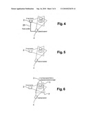 COMPUTERIZED IMAGING METHOD FOR A THREE-DIMENSIONAL RECONSTRUCTION FROM TWO-DIMENSIONAL RADIOLOGICAL IMAGES; IMPLEMENTATION DEVICE diagram and image