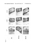 Use of Adipose-Tissue Cell Fractions for Post-Irradiation Tissue Regeneration diagram and image