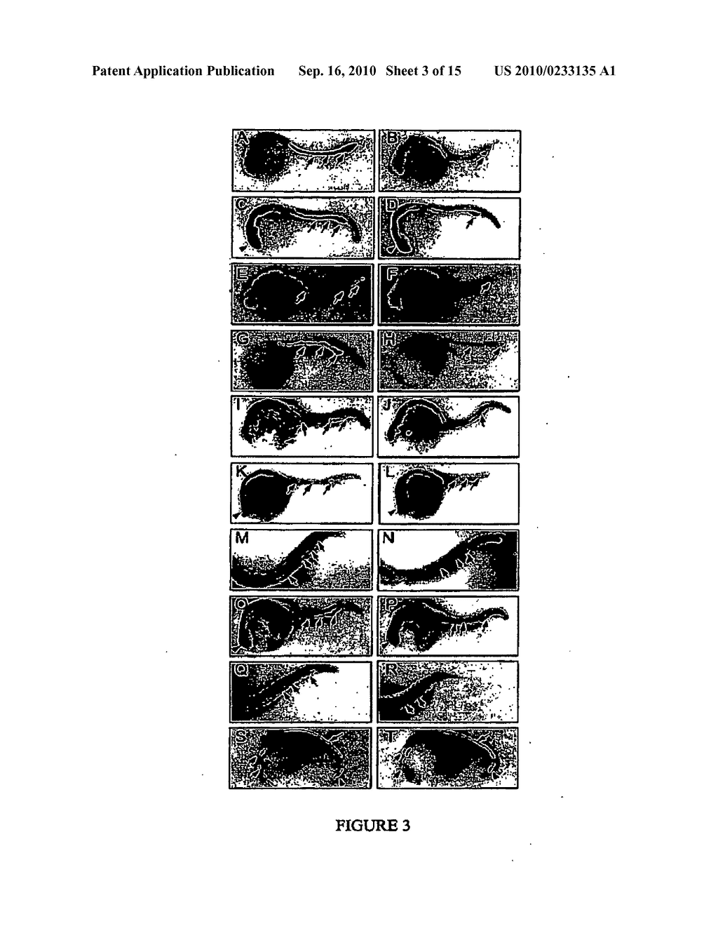 COMPOSITIONS AND METHODS FOR HEMATOPOIETIC STEM CELL EXPANSION OR FOR MODULATING ANGIOGENESIS - diagram, schematic, and image 04