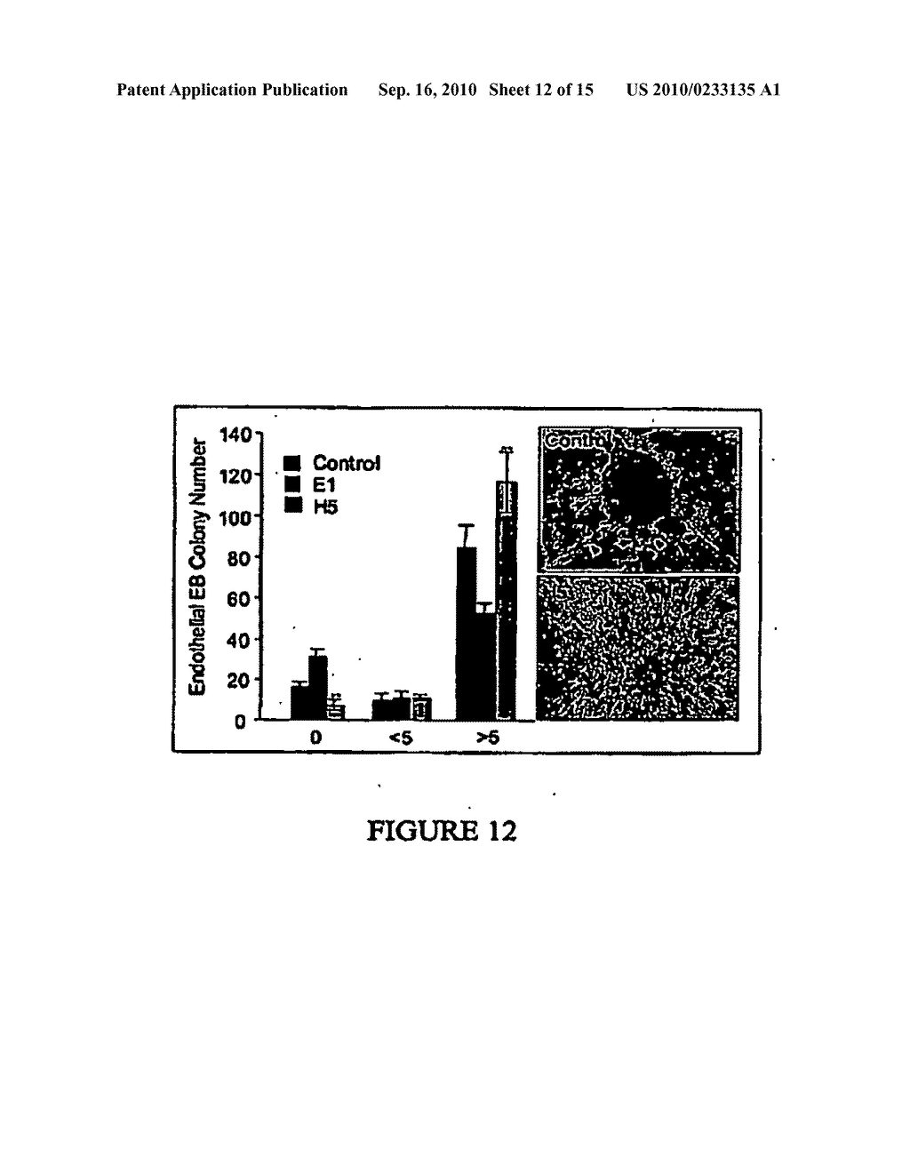 COMPOSITIONS AND METHODS FOR HEMATOPOIETIC STEM CELL EXPANSION OR FOR MODULATING ANGIOGENESIS - diagram, schematic, and image 13