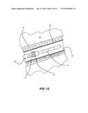 System and method for temporary or permanent disposal of nuclear waste diagram and image