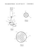 ENDOSCOPY DEVICE AND METHOD FOR SIMULTANEOUS OBSERVATION OF SEVERAL ZONES OF INTEREST diagram and image