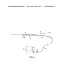 PHYSIOLOGICAL SENSOR DELIVERY DEVICE AND METHOD diagram and image