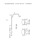 PHYSIOLOGICAL SENSOR DELIVERY DEVICE AND METHOD diagram and image